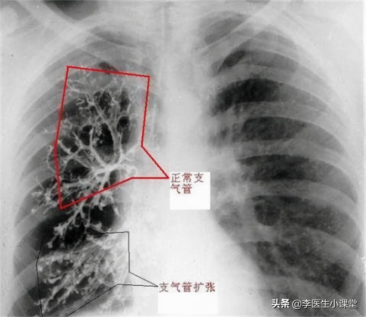 关于十个月大的宝宝有白头发的现象